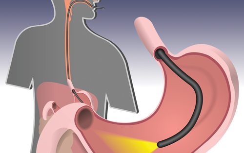 gastroscopy-fv-hospital