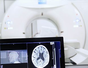 Chụp cắt lớp CT sử dụng kỹ thuật nào để quét khu vực cơ thể và tạo ra lát cắt ngang?
