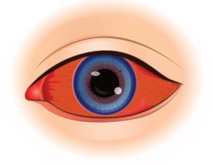Cơ vòng mống mắt có ảnh hưởng đến khả năng nhìn thấy của chúng ta không? Nếu có, thì làm thế nào?
