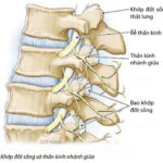 Tiêm Khớp Đốt Sống trong Điều trị đau