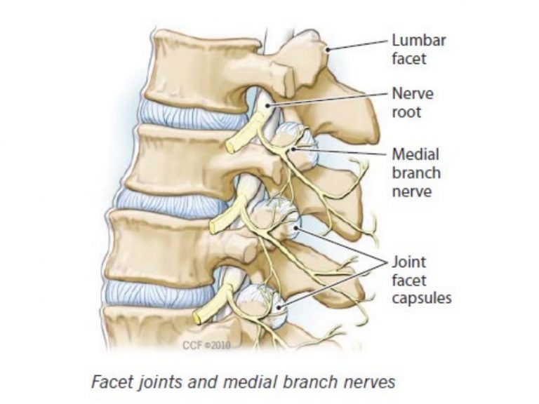 Facet Joint Injections For The Treatment Of Pain FV Hospital