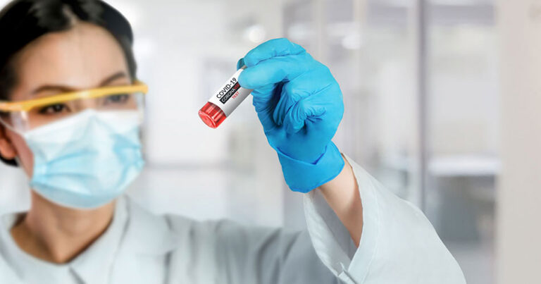 Covid-19 Antibody Testing (Serology)