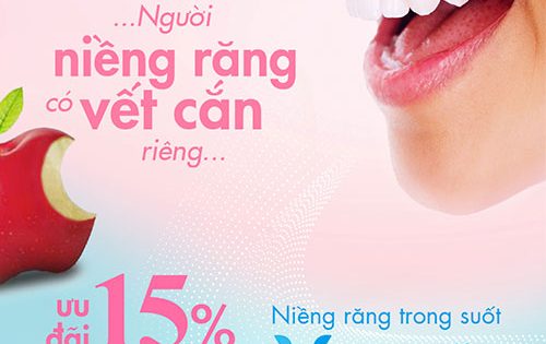 Nụ cười đẹp và răng đẹp có quan hệ như thế nào?
