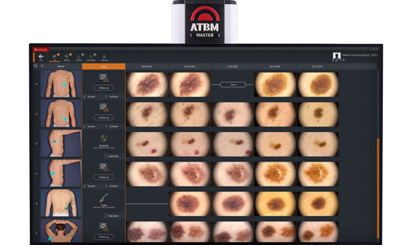 body-mapping-atbm-3