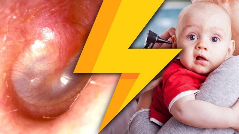 Biểu hiện của viêm tai giữa: Những điều ít ai biết!