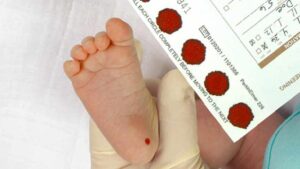 Sàng lọc sơ sinh là gì? Sàng lọc sơ sinh ở đâu chính xác?