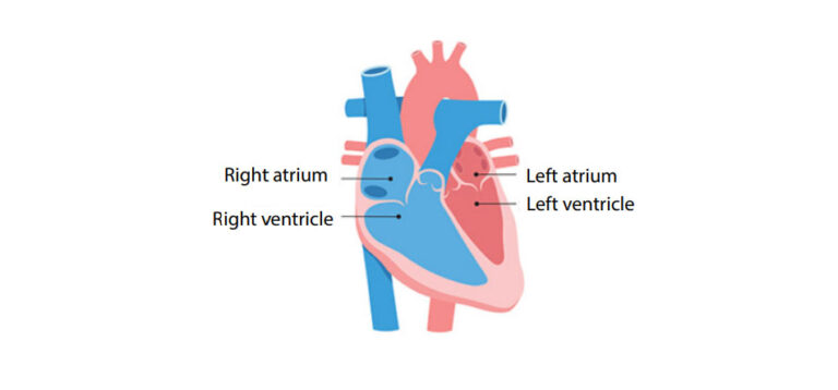 Atrial Fibrillation