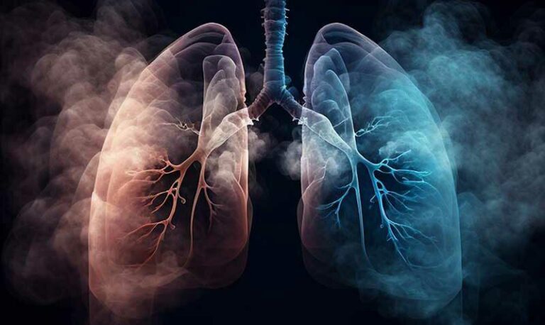 Biểu hiện của ung thư phổi: Đừng bỏ qua những dấu hiệu cảnh báo thầm lặng