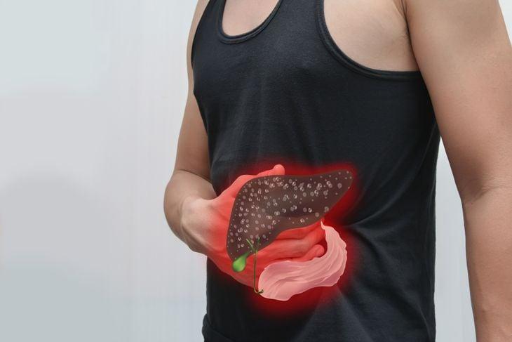 Ung thư gan giai đoạn cuối: Còn hy vọng sống không? Góc nhìn y khoa và cơ hội điều trị