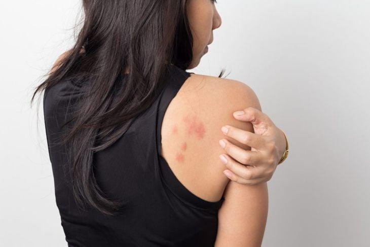 Điều trị ung thư da ở đâu tốt nhất?