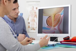 Điều trị Són tiểu