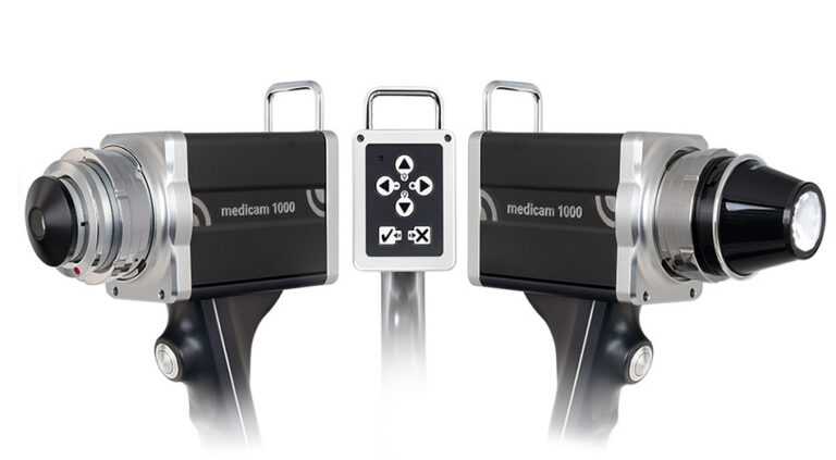 Early detection of skin cancer with FotoFinder Bodystudio automated total body mapping (ATBM)®