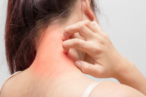 Dermatology