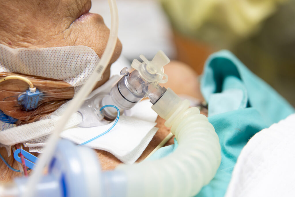 Patient do tracheostomy and ventilator in hospital